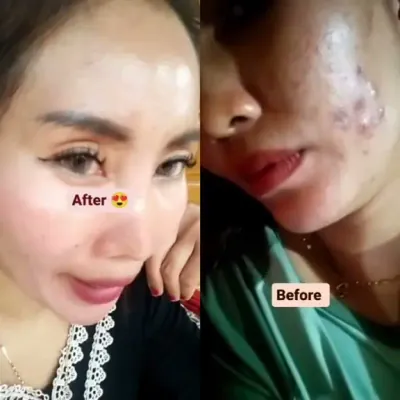 Testimoni pengguna DVN 1
